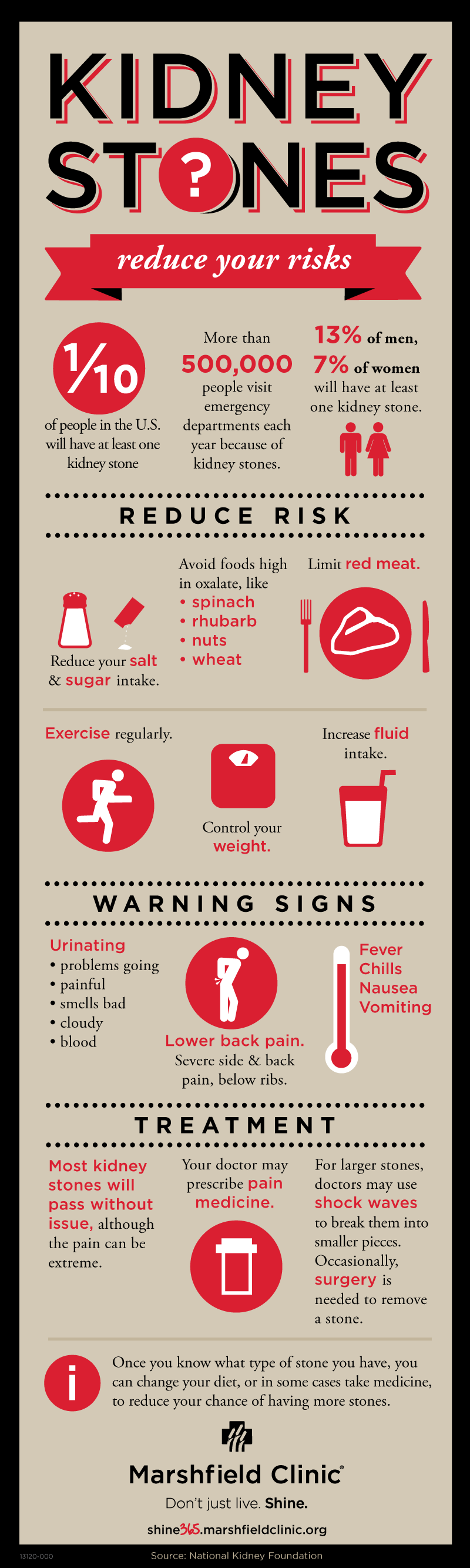 Kidney stones inforgraphic