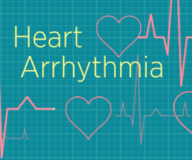 illustration of EKG heart arrhythmia pulse