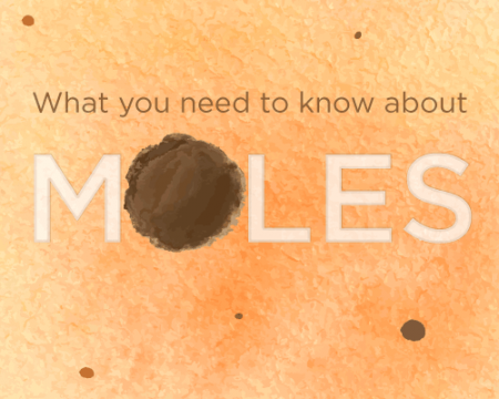 Illustration of moles