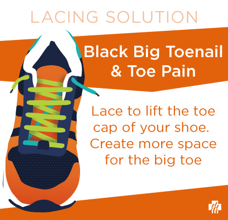 Lacing solution for black toes