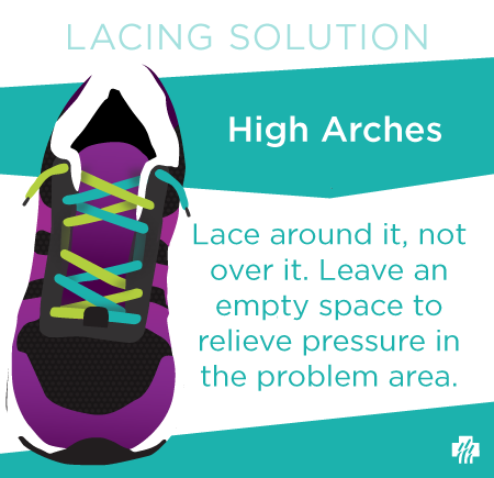 Lacing solution for high arches