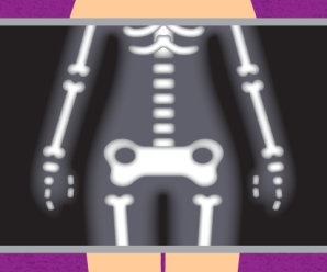 Big boned: Not a reason to be overweight