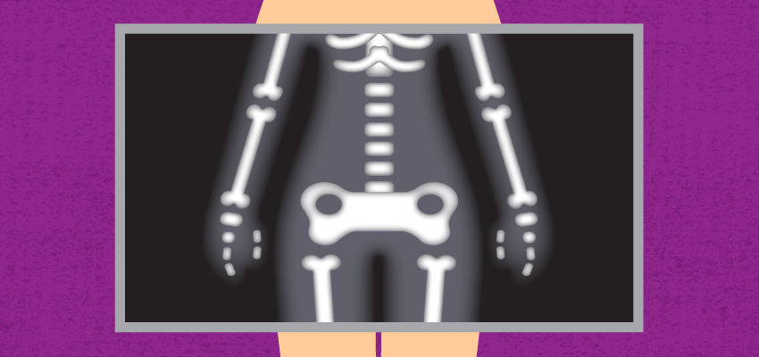 Big boned: Not a reason to be overweight