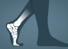Silhouette of feet illustrating foot bones - Feet and Orthotics
