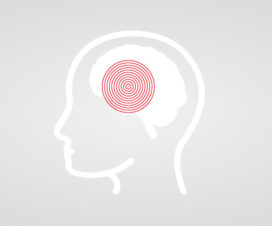 Graphic of target pinpointing over a silhouette of a person's brain - Brain cancer
