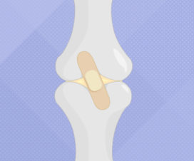Bone and joint with a band aid over the top, illustration - Will torn cartilage heal?