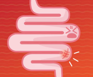 Graphic of cartoon intestine in pain - Colon polyps related to colon cancer