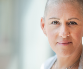 Chemotherapy: What you need to know