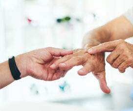 doctor examining a hand for Psoriasis arthritis
