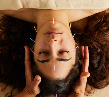 woman with dry needling in her face