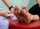 Plantar fibromas can cause pain on the bottom of the foot