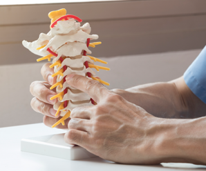 Cervical spine fusion: 3 things to know