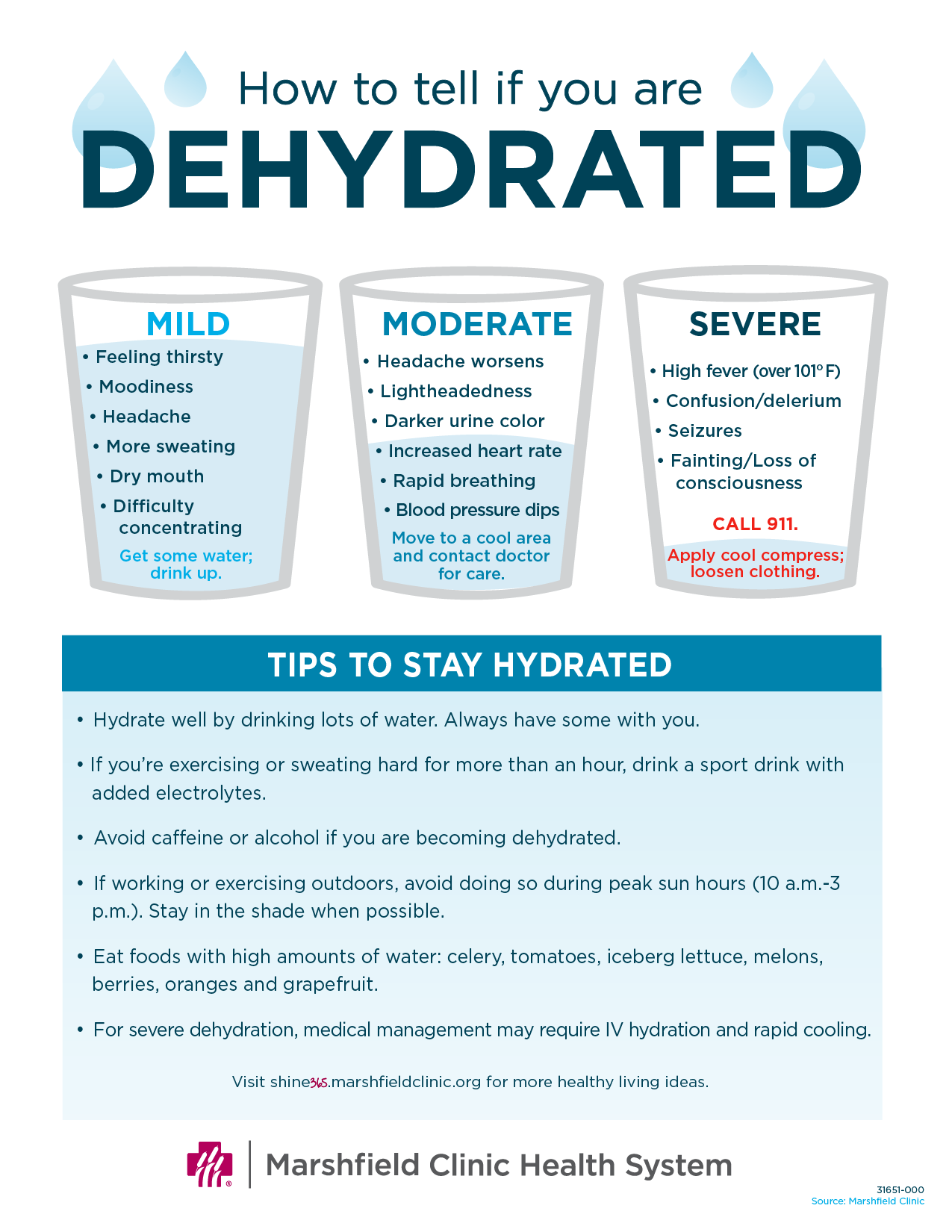 How to tell if you are dehydrated. This chart shows ways to know signs of dehydration and tips to stay hydrated