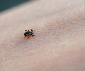 Tick removal if you are bit by a tick